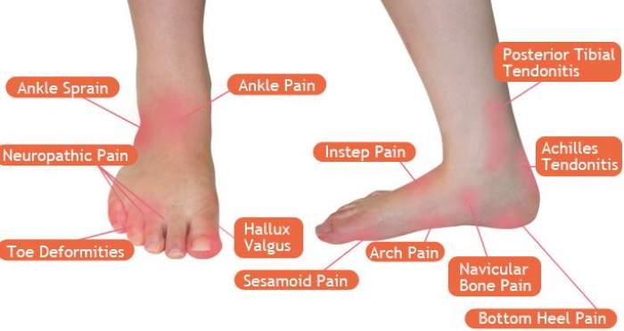 the-most-common-foot-and-ankle-problems-a-podiatrist-treats